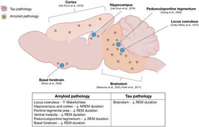 Progressive sleep disturbance in various transgenic mouse models of Alzheimer’s disease
